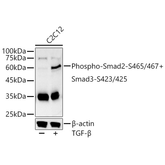 Phospho-Smad2-S465/467 + Smad3-S423/425 Rabbit Polyclonal Antibody