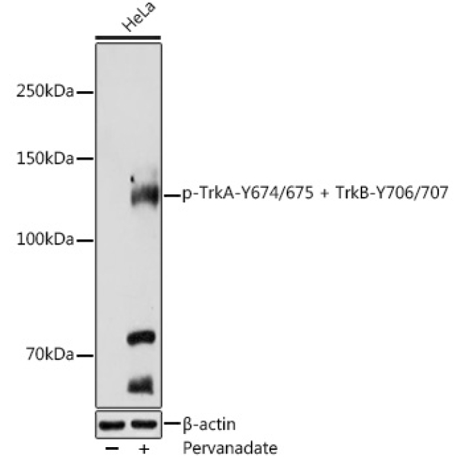 Phospho-TrkA-Y674/675 + TrkB-Y706/707 Rabbit Polyclonal Antibody