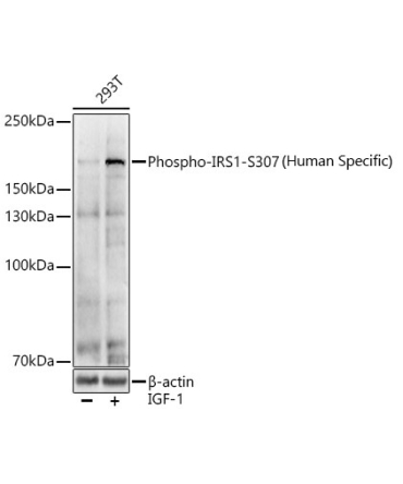 Phospho-IRS1-S307(Human Specific) Rabbit Polyclonal Antibody