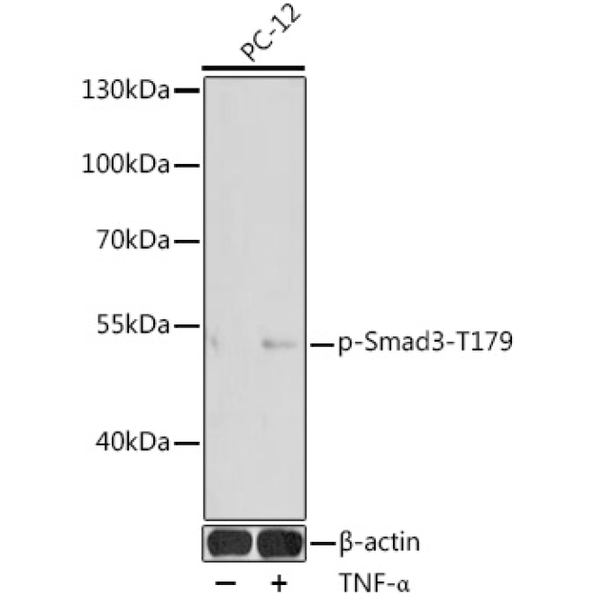 Phospho-Smad3-T179 Rabbit Polyclonal Antibody
