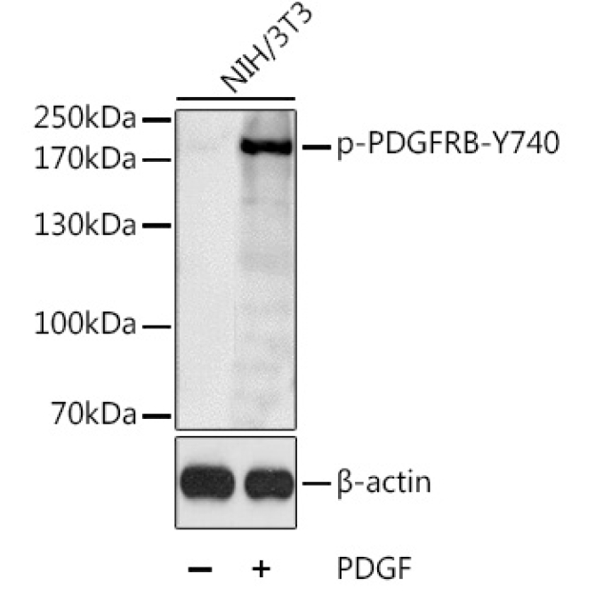 Phospho-PDGFRB-Y740 Rabbit Polyclonal Antibody