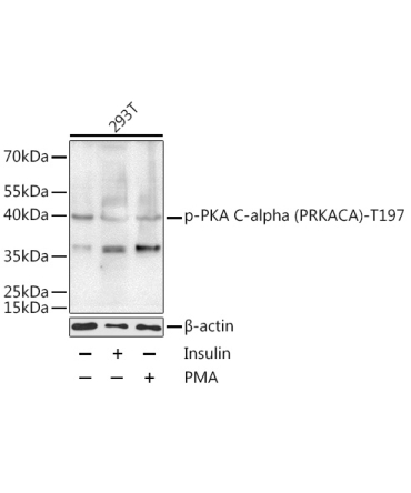 Phospho-PKA C-alpha (PRKACA)-T197 Rabbit Polyclonal Antibody