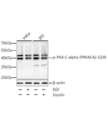 Phospho-PKA C-alpha (PRKACA)-S339 Rabbit Polyclonal Antibody