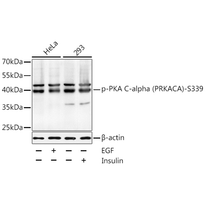 Phospho-PKA C-alpha (PRKACA)-S339 Rabbit Polyclonal Antibody