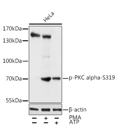 Phospho-PKC alpha-S319 Rabbit Polyclonal Antibody