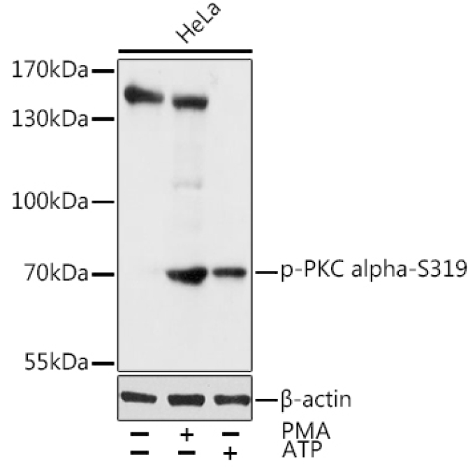 Phospho-PKC alpha-S319 Rabbit Polyclonal Antibody