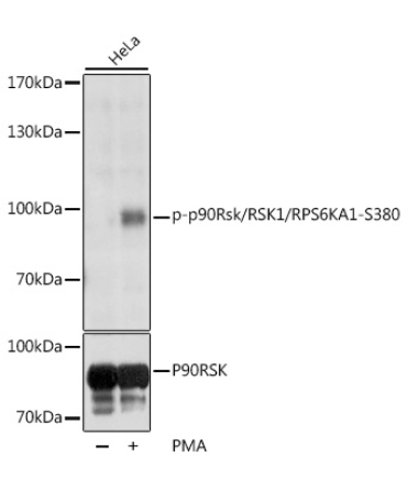 Phospho-p90Rsk/RSK1/RPS6KA1-S380 Rabbit Polyclonal Antibody