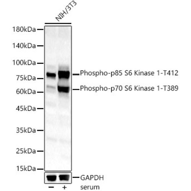 Phospho-p70 S6 Kinase 1-T389 Rabbit Polyclonal Antibody