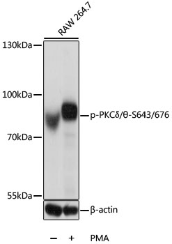 Phospho-PKCDelta/?-S643/676 Rabbit Polyclonal Antibody