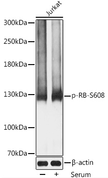 Phospho-RB-S608 Rabbit Polyclonal Antibody