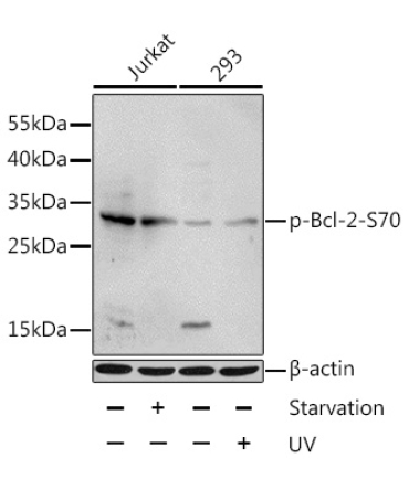 Phospho-Bcl-2-S70 Rabbit Polyclonal Antibody