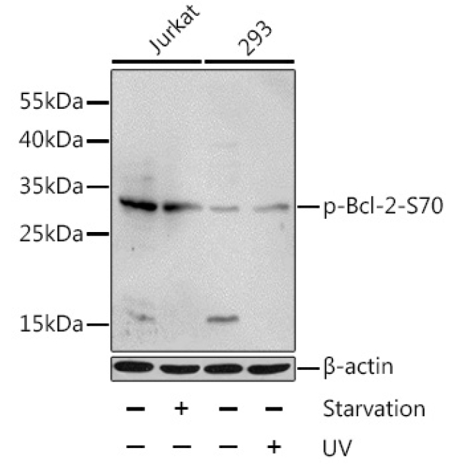 Phospho-Bcl-2-S70 Rabbit Polyclonal Antibody