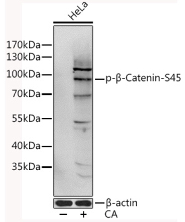Phospho-Beta-Catenin-S45 Rabbit Polyclonal Antibody