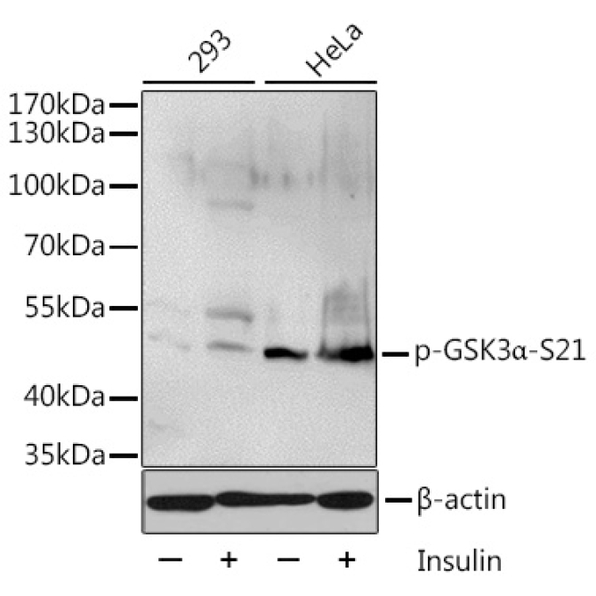 Phospho-GSK3Alpha-S21 Rabbit Polyclonal Antibody