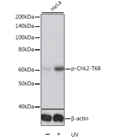 Phospho-Chk2-T68 Rabbit Polyclonal Antibody