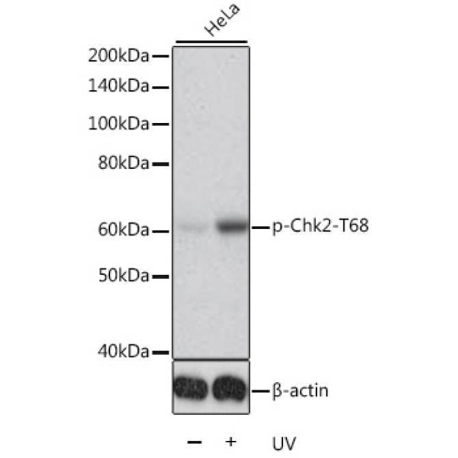Phospho-Chk2-T68 Rabbit Polyclonal Antibody