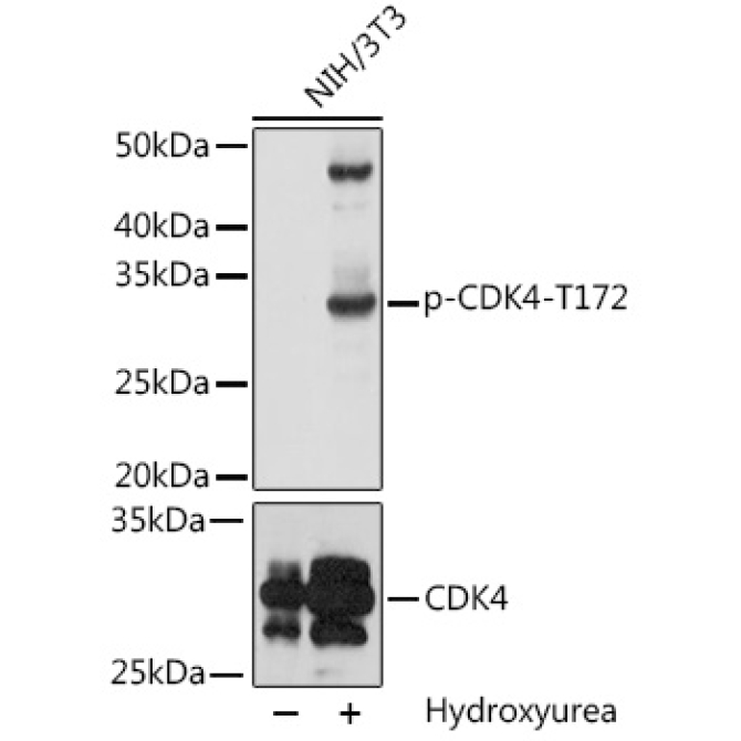 Phospho-CDK4-T172 Rabbit Polyclonal Antibody