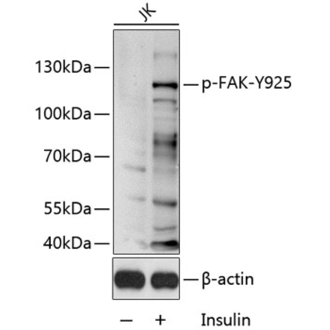 Phospho-FAK-Y925 Rabbit Polyclonal Antibody