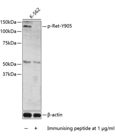 Phospho-Ret-Y905 Rabbit Polyclonal Antibody