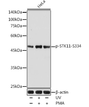 Phospho-STK11-S334 Rabbit Polyclonal Antibody
