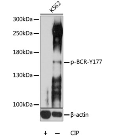 Phospho-BCR-Y177 Rabbit Polyclonal Antibody