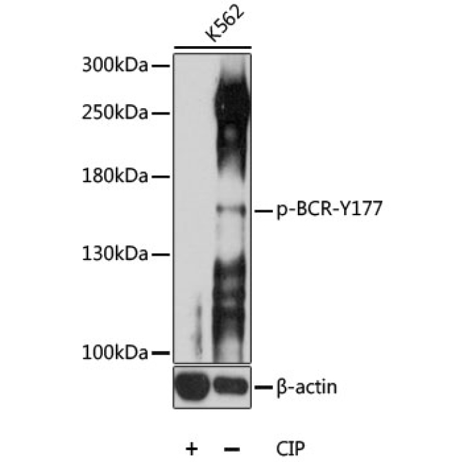 Phospho-BCR-Y177 Rabbit Polyclonal Antibody