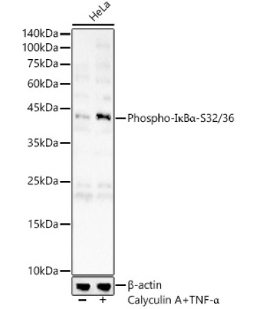 Phospho-I?BAlpha-S32/36 Rabbit Polyclonal Antibody