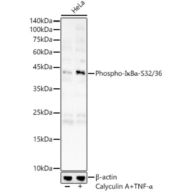 Phospho-I?BAlpha-S32/36 Rabbit Polyclonal Antibody