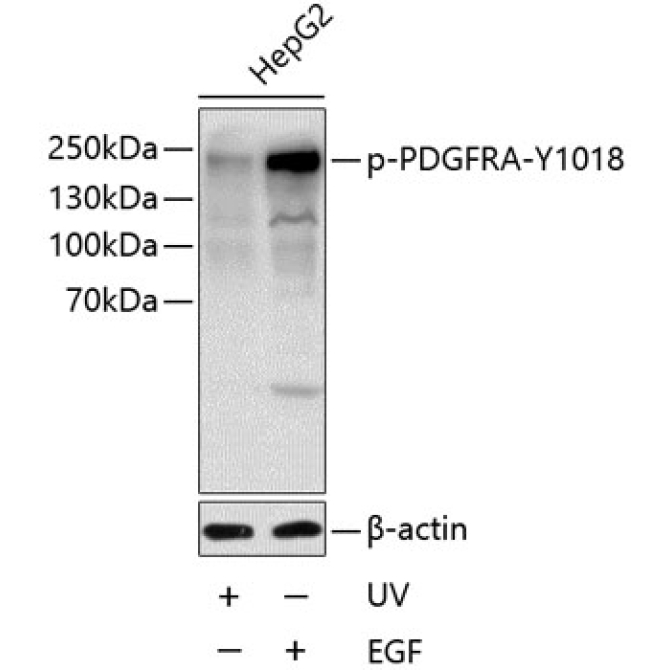 Phospho-PDGFR alpha-Y1018 Rabbit Polyclonal Antibody