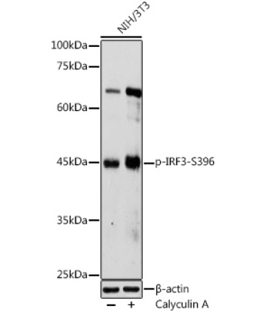 Phospho-IRF3-S396 Rabbit Polyclonal Antibody