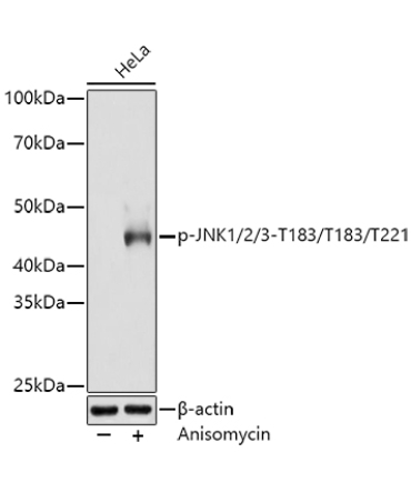 Phospho-JNK1/2/3-T183/T183/T221 Rabbit Monoclonal Antibody