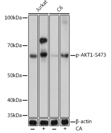 Phospho-AKT-S473 Rabbit Monoclonal Antibody