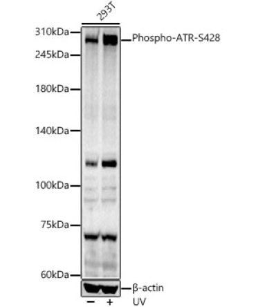 Phospho-ATR-S428 Rabbit Polyclonal Antibody