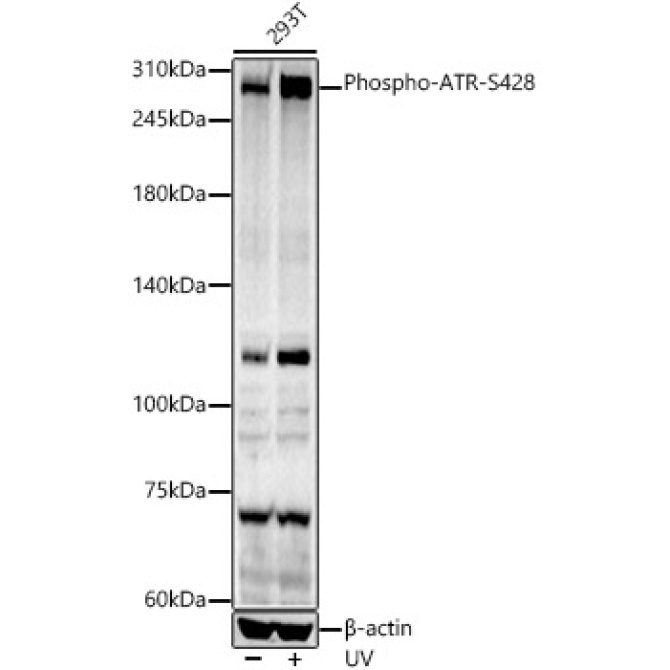 Phospho-ATR-S428 Rabbit Polyclonal Antibody