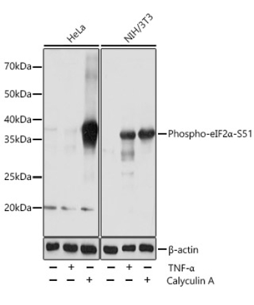 Phospho-eIF2Alpha-S51 Rabbit Monoclonal Antibody
