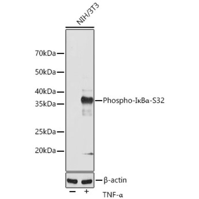 Phospho-I?BAlpha-S32 Rabbit Monoclonal Antibody
