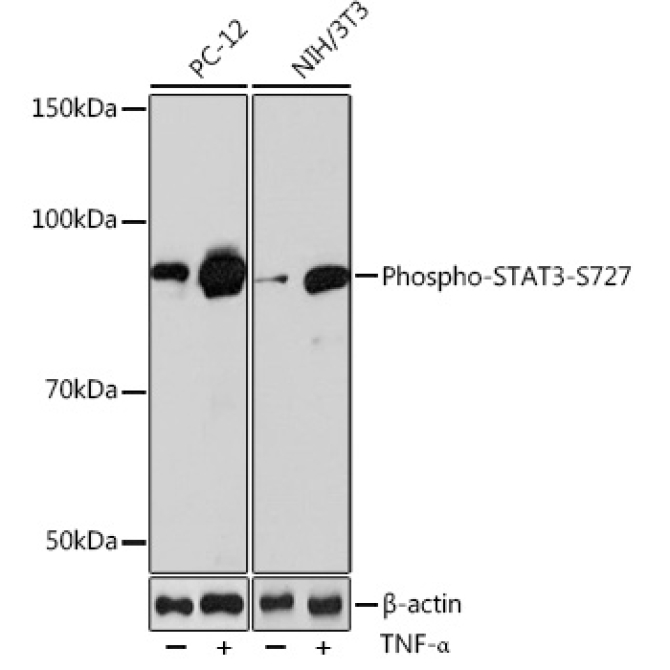 Phospho-STAT3-S727 Rabbit Monoclonal Antibody