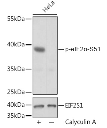 Phospho-eIF2Alpha-S51 Rabbit Polyclonal Antibody