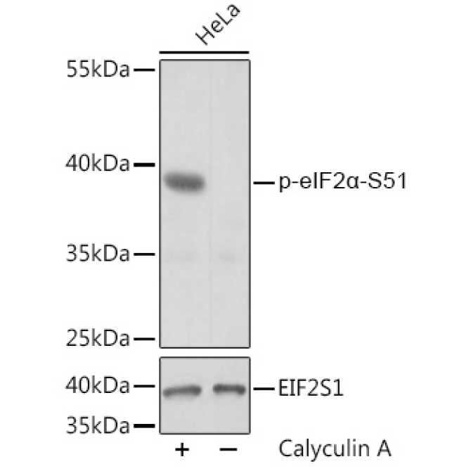 Phospho-eIF2Alpha-S51 Rabbit Polyclonal Antibody