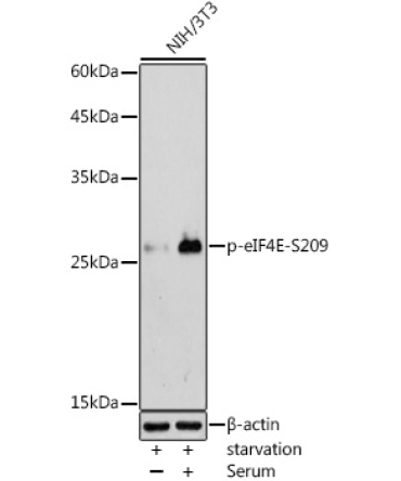 Phospho-eIF4E-S209 Rabbit Polyclonal Antibody