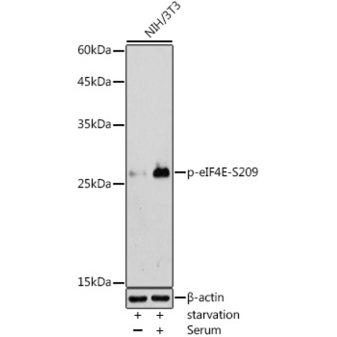 Phospho-eIF4E-S209 Rabbit Polyclonal Antibody