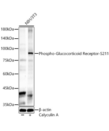 Phospho-Glucocorticoid Receptor-S211 Rabbit Polyclonal Antibody