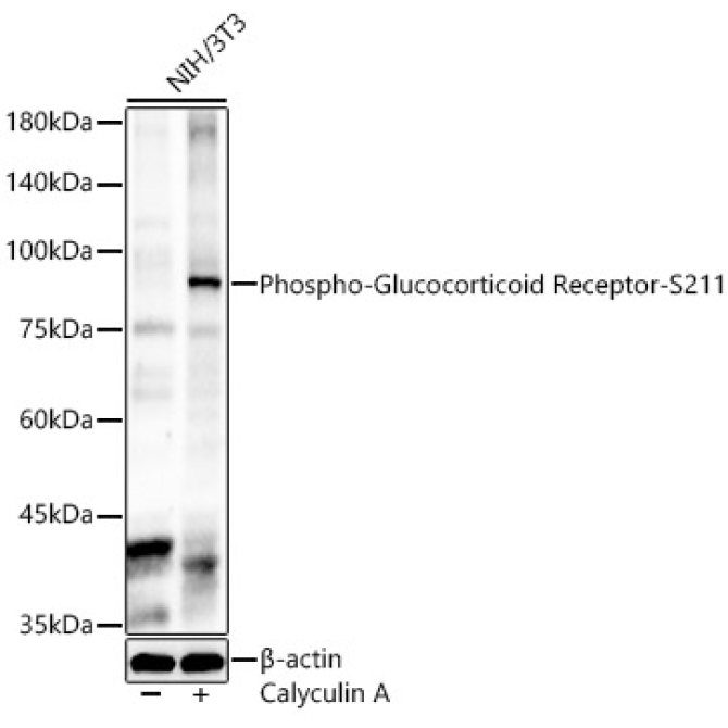 Phospho-Glucocorticoid Receptor-S211 Rabbit Polyclonal Antibody