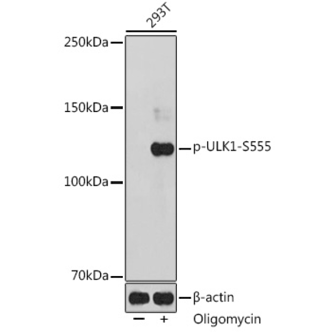 Phospho-ULK1-S555 Rabbit Polyclonal Antibody