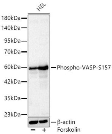 Phospho-VASP-S157 Rabbit Polyclonal Antibody