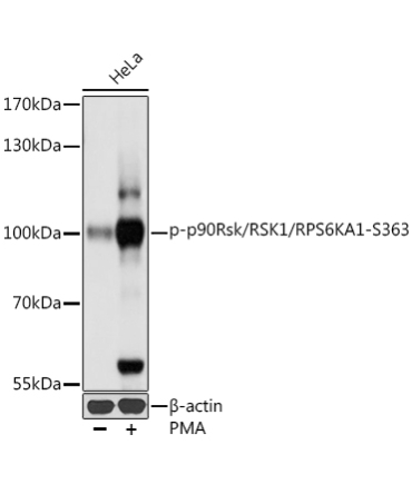 Phospho-p90Rsk/RSK1/RPS6KA1-S363 Rabbit Polyclonal Antibody