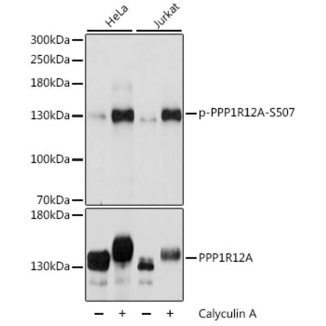 Phospho-PPP1R12A-S507 Rabbit Polyclonal Antibody