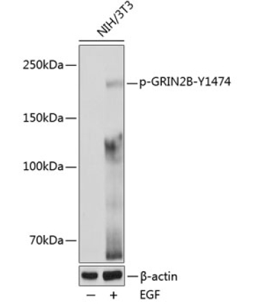 Phospho-GRIN2B-Y1474 Rabbit Polyclonal Antibody