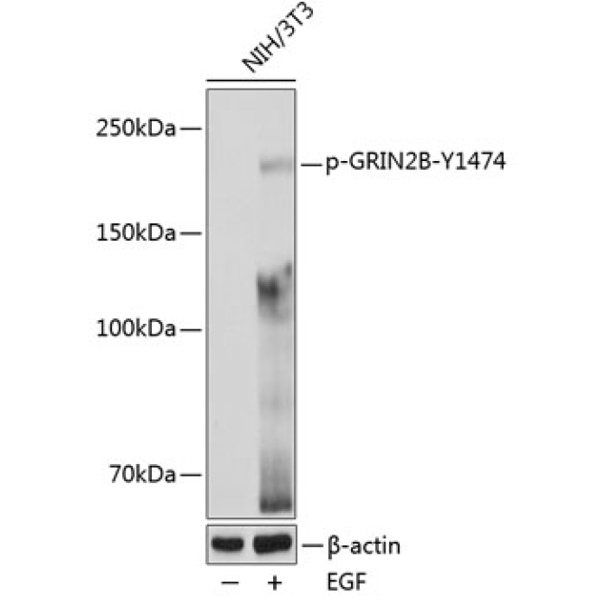 Phospho-GRIN2B-Y1474 Rabbit Polyclonal Antibody