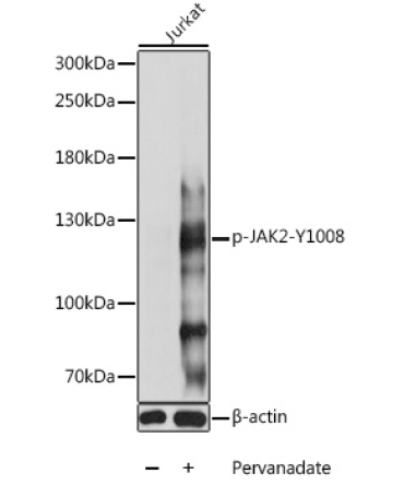 Phospho-JAK2-Y1008 Rabbit Polyclonal Antibody